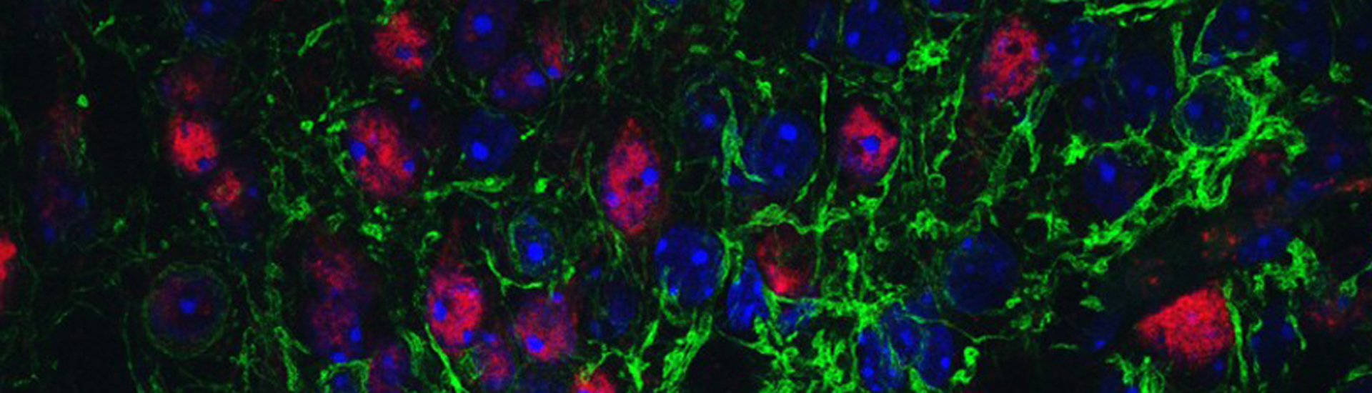 大腦在工作記憶中存儲信息的神經(jīng)機(jī)制